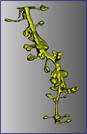 Reconstruction of a dendritic section as seen through simulated emission depletion STED microscopy